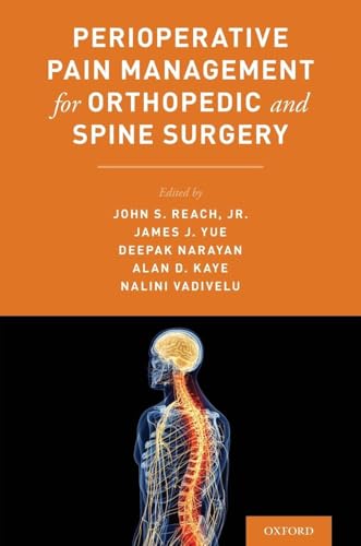 Perioperative Pain Management for Orthopedic and Spine Surgery
