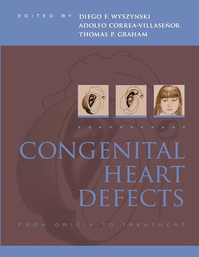 Congenital Heart Defects