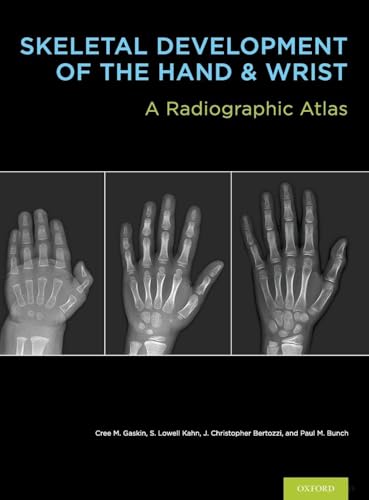 SKEL DEVELOP HAND & WRIST BK & DVD PCK