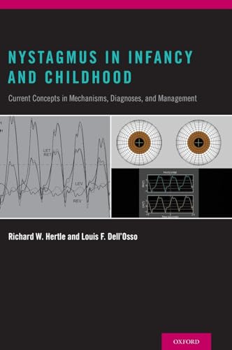 Nystagmus in Infancy and Childhood