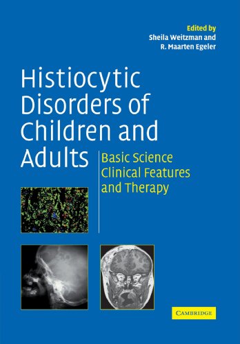 Histiocytic Disorders of Children and Adults