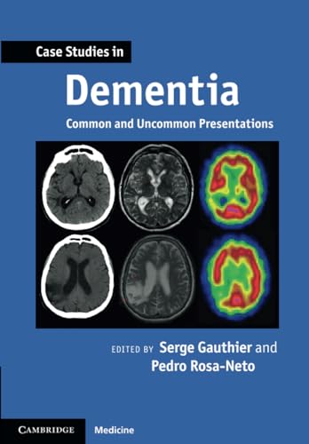 Case Studies in Dementia