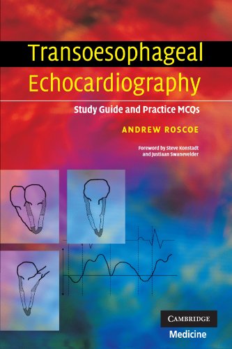 Transoesophageal Echocardiography