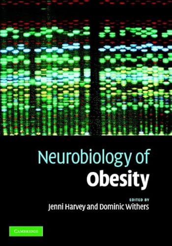 Neurobiology of Obesity