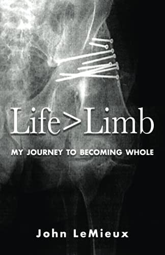 Life is Greater Than Limb