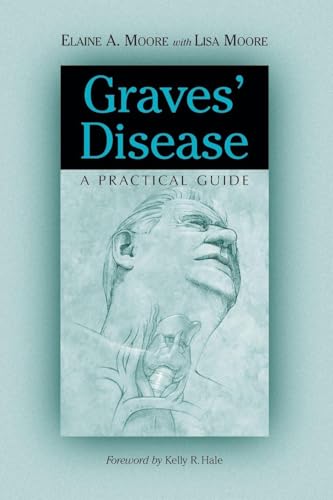 Graves' Disease