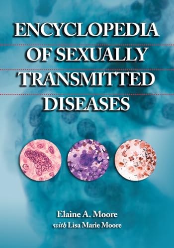 Encyclopedia of Sexually Transmitted Diseases