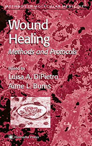Wound Healing