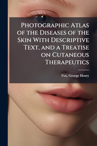 Photographic Atlas of the Diseases of the Skin With Descriptive Text, and a Treatise on Cutaneous Therapeutics