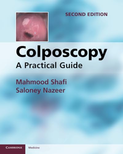 Colposcopy