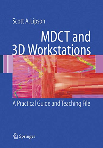 Mdct and 3D Workstations