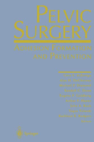 Pelvic Surgery