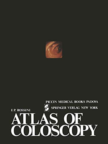Atlas of Coloscopy