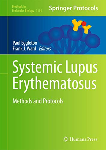 Systemic Lupus Erythematosus