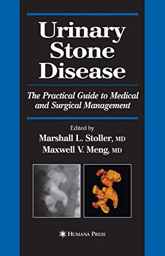 Urinary Stone Disease