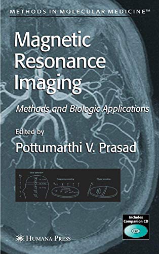 Magnetic Resonance Imaging