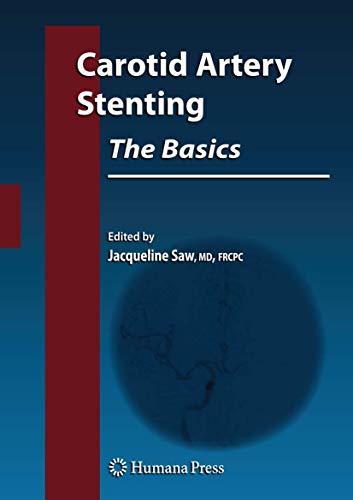 Carotid Artery Stenting