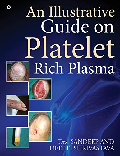 An Illustrative Guide on Platelet Rich Plasma