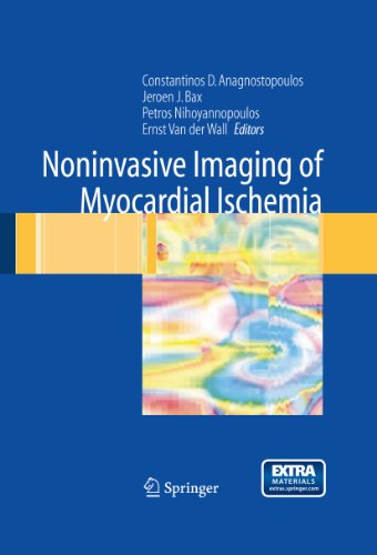 Noninvasive Imaging of Myocardial Ischemia