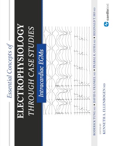 Essential Concepts of Electrophysiology Through Case Studies