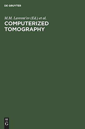 Computerized Tomography
