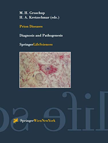 Prion Diseases