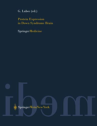 Protein Expression in Down Syndrome Brain
