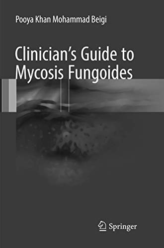 Clinician's Guide to Mycosis Fungoides