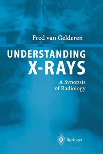 Understanding X-Rays