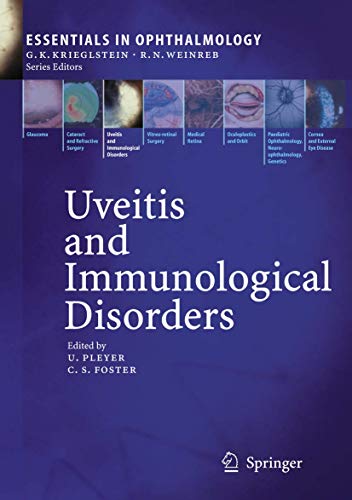 Uveitis and Immunological Disorders