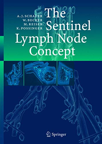 The Sentinel Lymph Node Concept