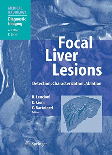 Focal Liver Lesions