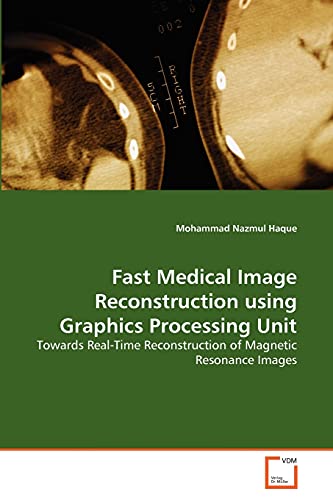 Fast Medical Image Reconstruction using Graphics Processing Unit