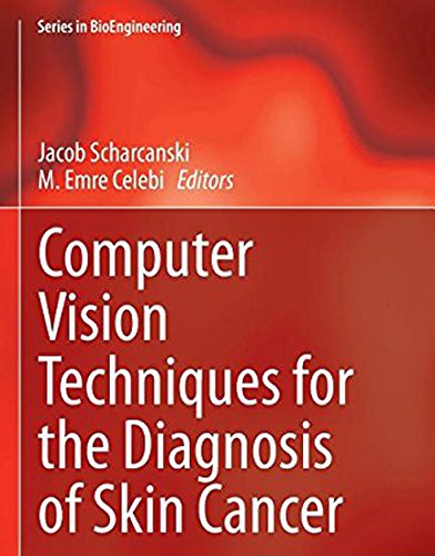Computer Vision Techniques for the Diagnosis of Skin Cancer