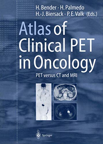 Atlas of Clinical Pet in Oncology