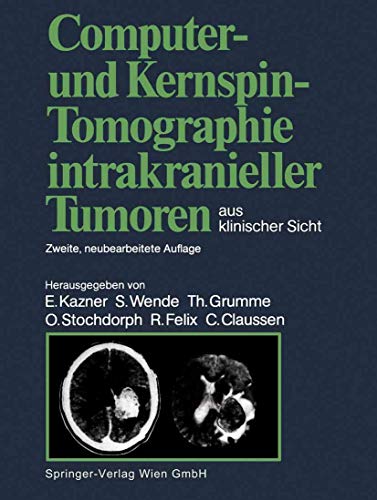 Computer- Und Kernspin-Tomographie Intrakranieller Tumoren Aus Klinischer Sicht