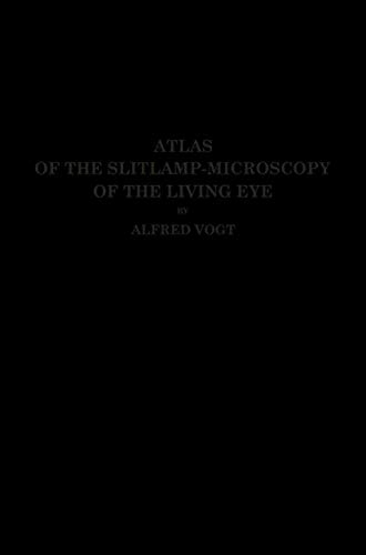 Atlas of the Slitlamp-Microscopy of the Living Eye