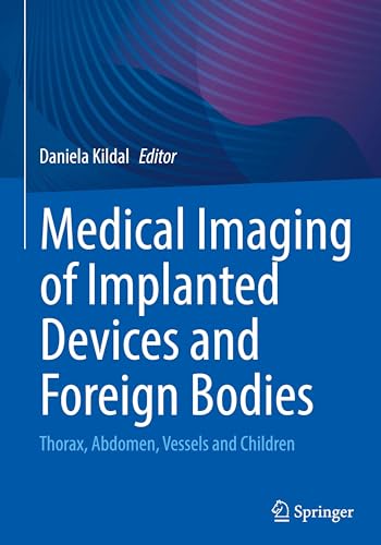 Medical Imaging of Implanted Devices and Foreign Bodies