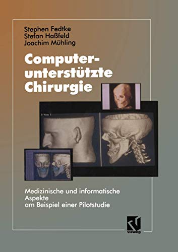 Computerunterstutzte Chirurgie