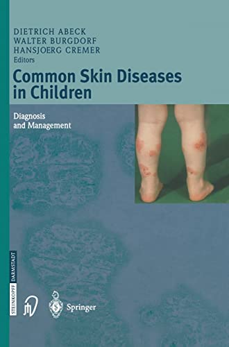 Common Skin Diseases in Children