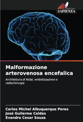 Malformazione arterovenosa encefalica
