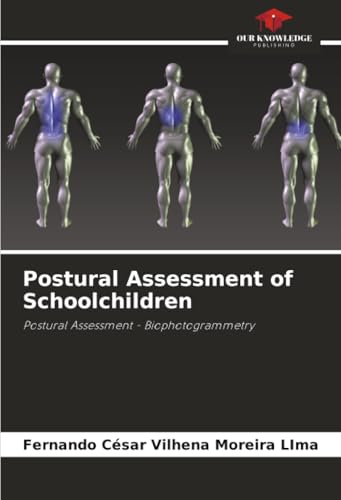Postural Assessment of Schoolchildren
