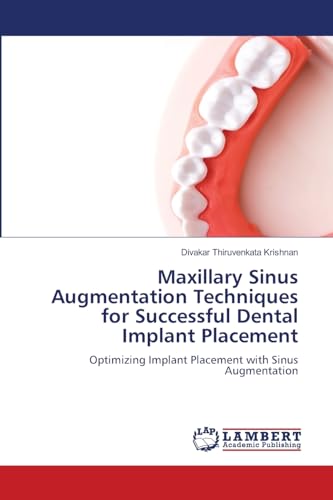 Maxillary Sinus Augmentation Techniques for Successful Dental Implant Placement