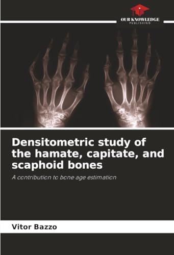 Densitometric study of the hamate, capitate, and scaphoid bones