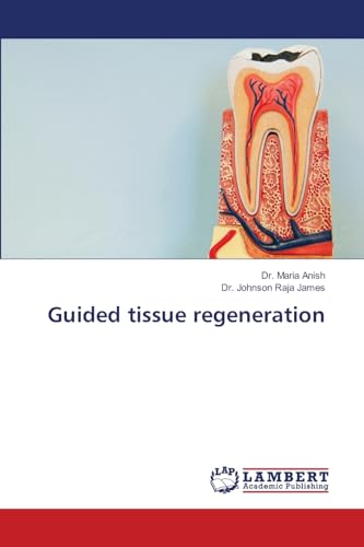 Guided tissue regeneration