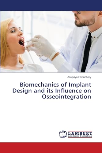 Biomechanics of Implant Design and its Influence on Osseointegration