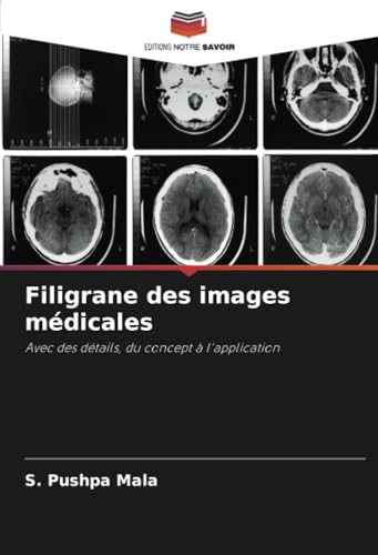 Filigrane des images médicales