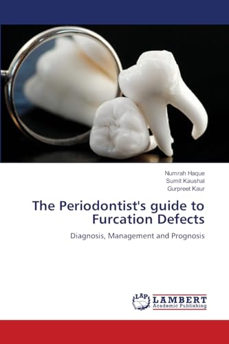 The Periodontist's guide to Furcation Defects