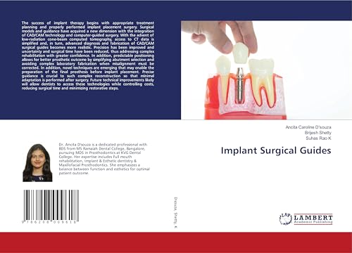 Implant Surgical Guides