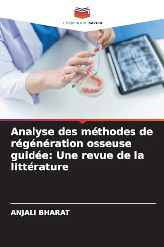 Analyse des méthodes de régénération osseuse guidée
